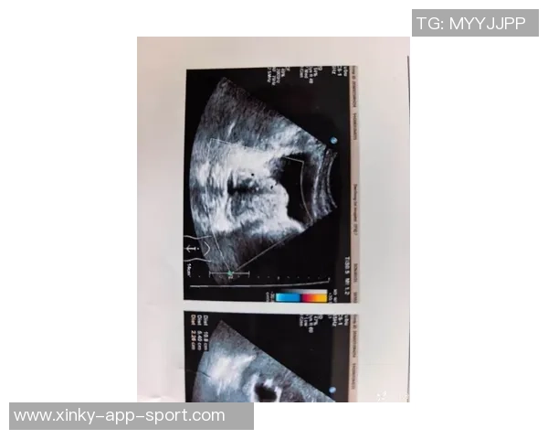 东契奇腹股沟MRI结果良好雷迪克表示他的状态将每日观察